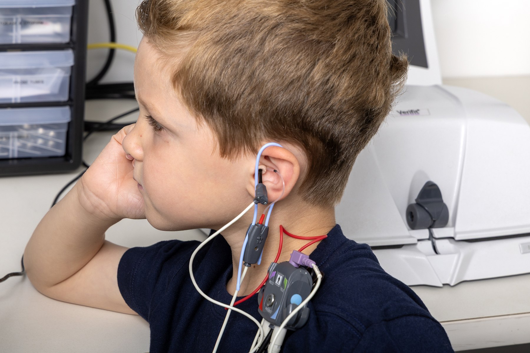 Child Hearing Loss