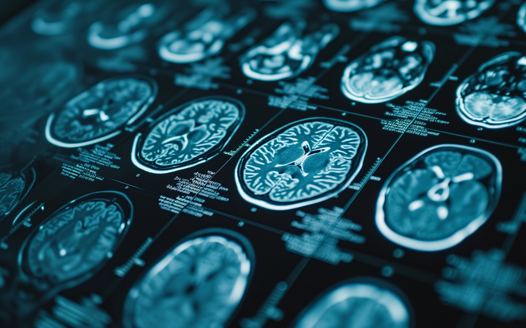 Brain Scan