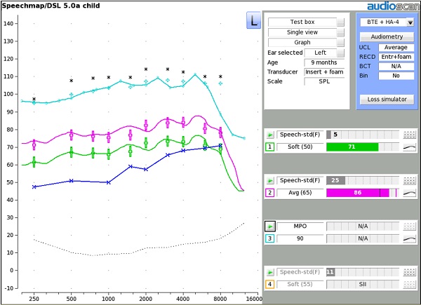Figure 2. Verifying output of the hearing aid.